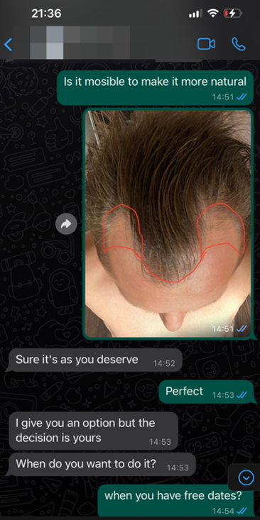 whatsapp clínica de transplante capilar 4