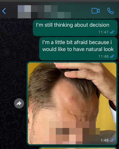 whatsapp clínica de transplante capilar 3