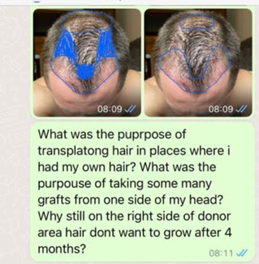 mensagem whatsapp clínica de transplante capilar 6