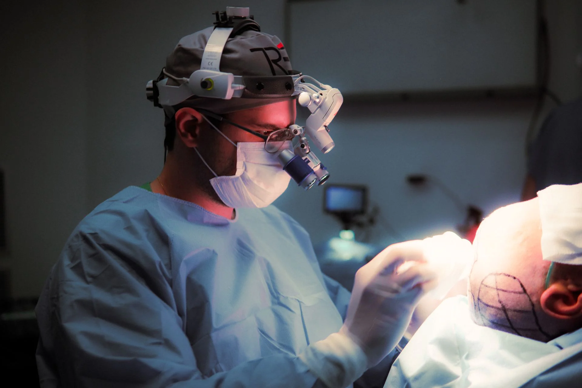 um médico realizando uma correção de transplante capilar
